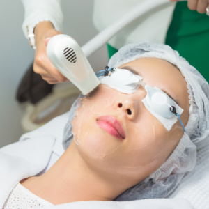 IPL treatment in oasis clinic shimla