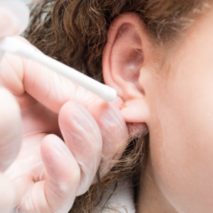 Ear piercing at oasis clinic shimla