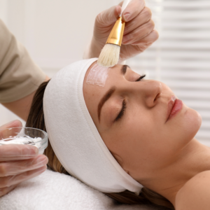 Chemical Peel Off treatment in Oasis Clinic